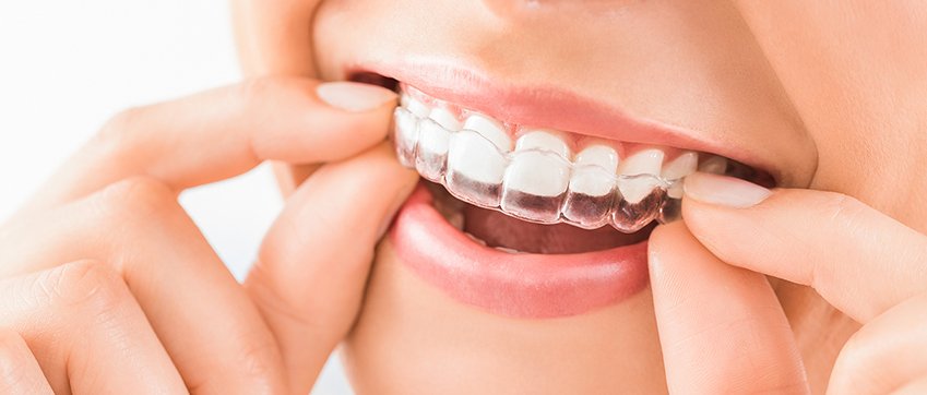 invisalign doctors site